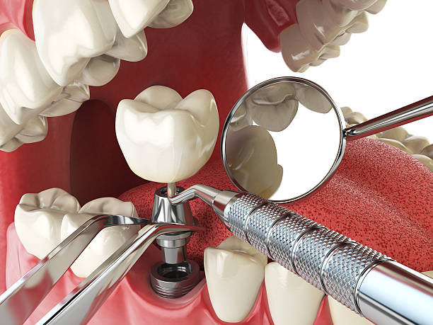 Best 24-Hour Emergency Dental Care in Harlan, IN
